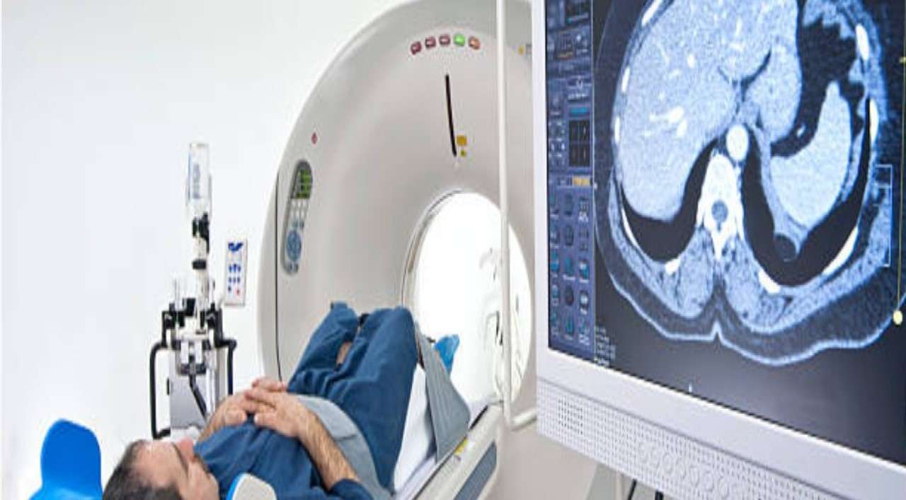 Why Take DOPA PET CT SCAN